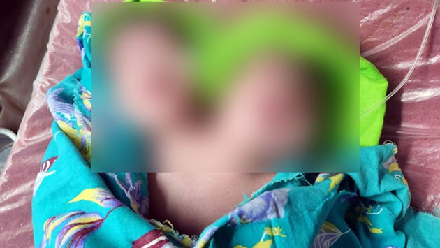 Image not available
